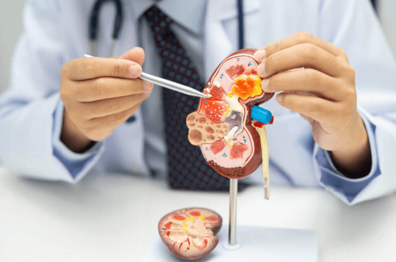 Finding the Right Kidney Specialist in San Antonio for Comprehensive Kidney Care