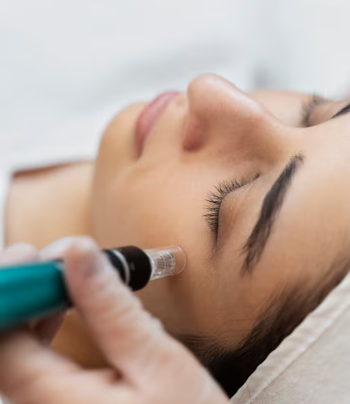 Looking for Microneedling Near Me in London? Here's How to Compare Clinics Beyond Before-and-After Photos