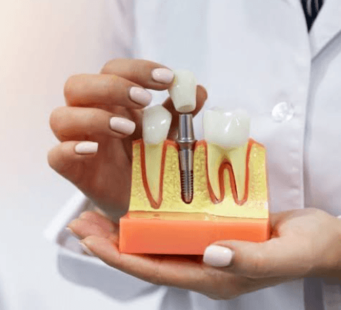 3 Benefits Of Choosing A Dentist Who Offers Same Day Restorations