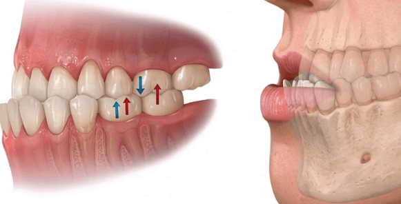 Why Front Tooth Length Should Be Evaluated Alongside Bite Function